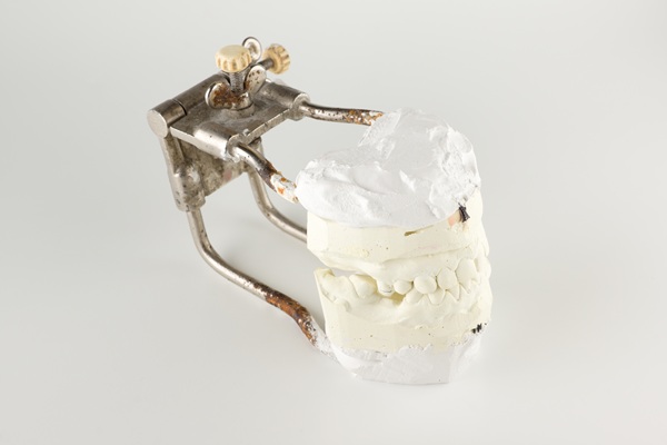 What You Should Ask Your Dentist Before A Bone Grafting Procedure