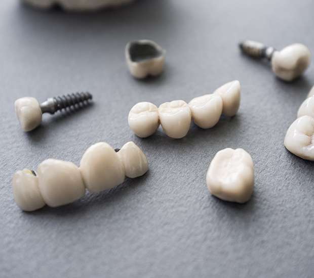 Danville The Difference Between Dental Implants and Mini Dental Implants