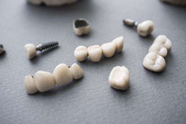 Types of Dental Implants from Gregory K. Louie DDS, PC in Danville, CA